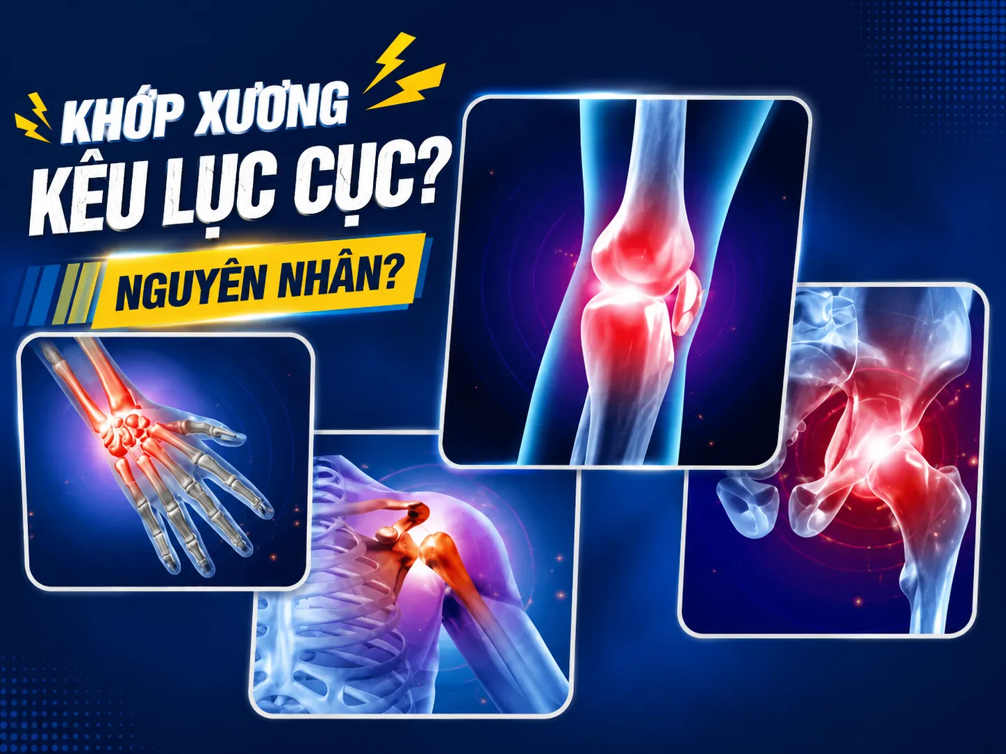 Lý do các khớp xương kêu lục cục? Nguyên nhân và biện pháp khắc phục